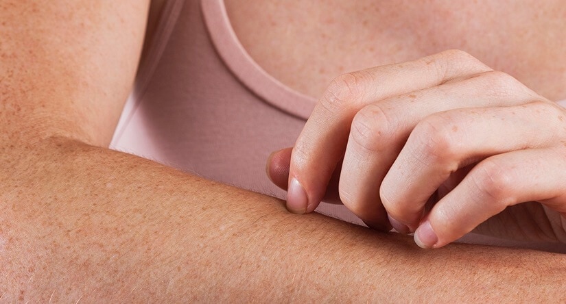 De verzorging van de jeukende huid: oorzaken, behandeling en preventie